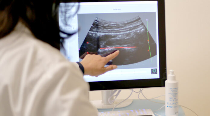 Osteoporosi